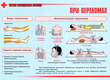 ПВ05 Первая помощь при чрезвычайных ситуациях (самокл.пленка, А3, 9 листов) - Плакаты - Медицинская помощь - Магазин охраны труда ИЗО Стиль
